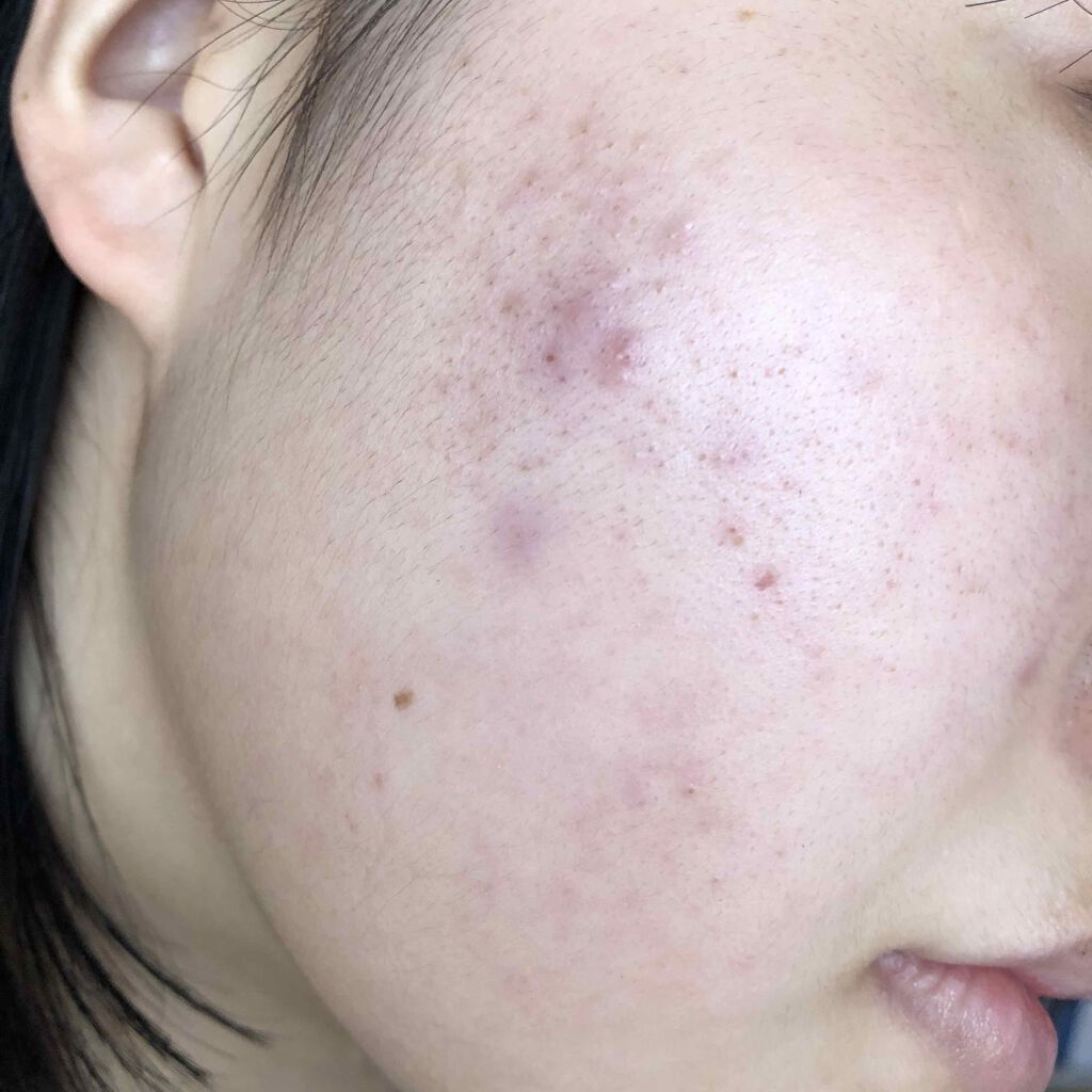 化粧水・敏感肌用・高保湿タイプ/無印良品/化粧水を使ったクチコミ（3枚目）