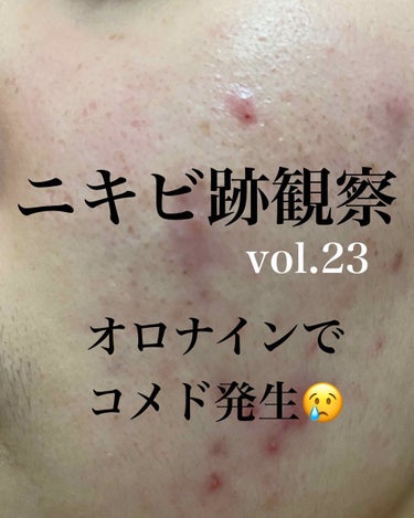 敏感肌用薬用美白美容液/無印良品/美容液を使ったクチコミ（1枚目）