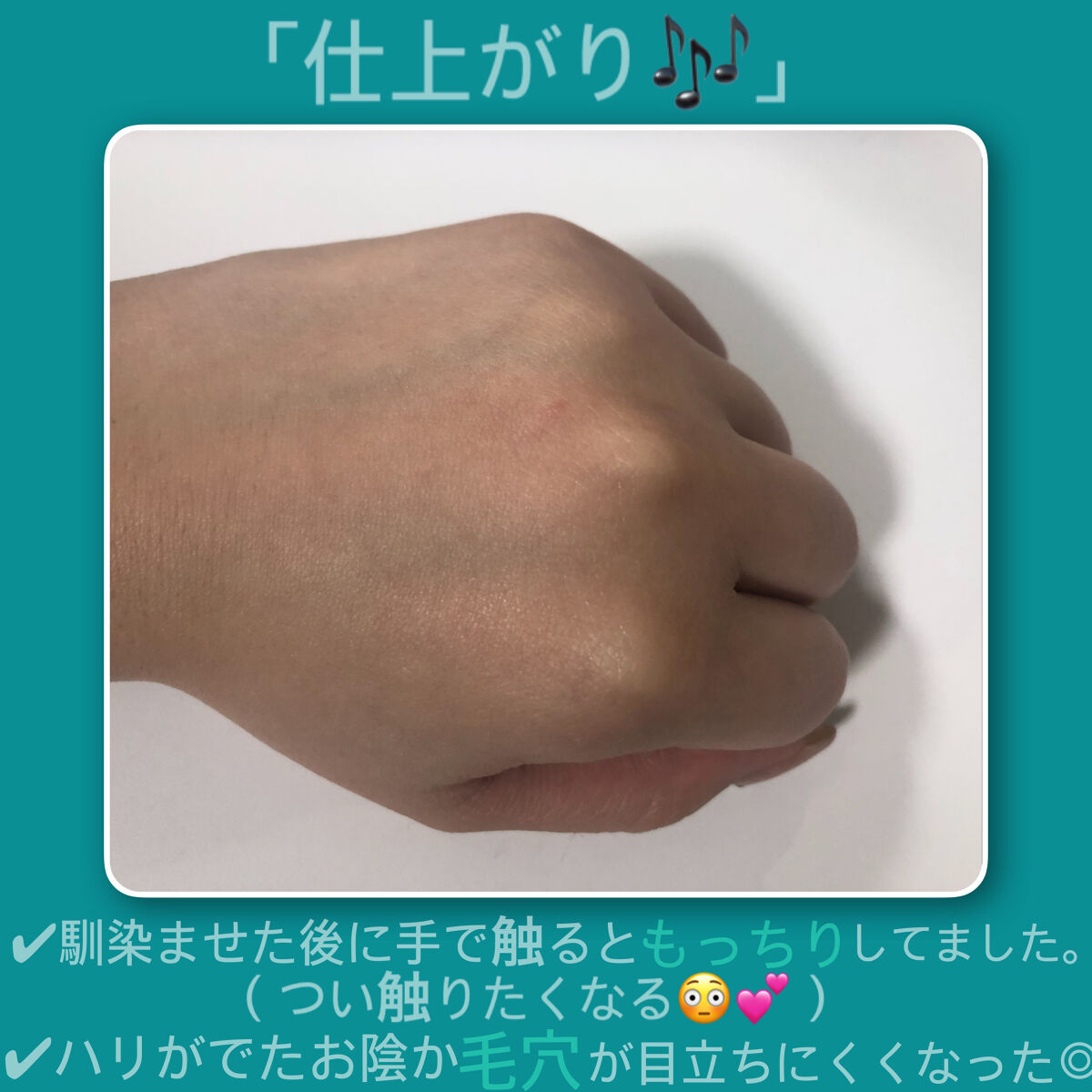 エファクラ ピールケア セラム/ラ ロッシュ ポゼ/美容液を使ったクチコミ（3枚目）