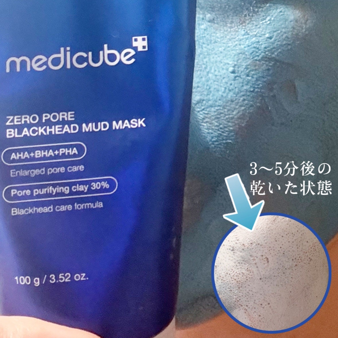 ゼロ毛穴クレイパック/MEDICUBE/洗い流すパック・マスクを使ったクチコミ(5枚目)