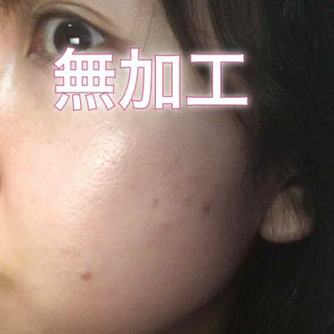 さやや on LIPS 「30代過ぎて人生でこんなに肌荒れしたの初めてです😣原因はストレ..」（1枚目）