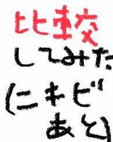 はい、またまた汚い表紙ですみません。(表紙が1番大切なのに…)

今回はニキビ跡に効くと話題の２つの美容液(メラノccとバイオイル)を実際に1ヶ月土門が試して、比較してみました。良いところ、ちょっと…と