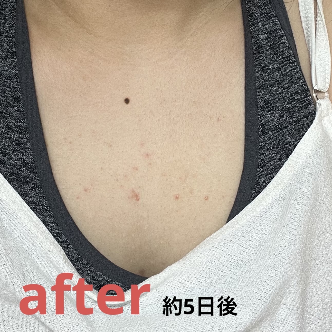 セナキュア(医薬品)/小林製薬/その他を使ったクチコミ（3枚目）