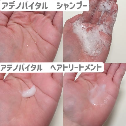 アデノバイタル  シャンプー/サブリミック/サロンシャンプーを使ったクチコミ(3枚目)