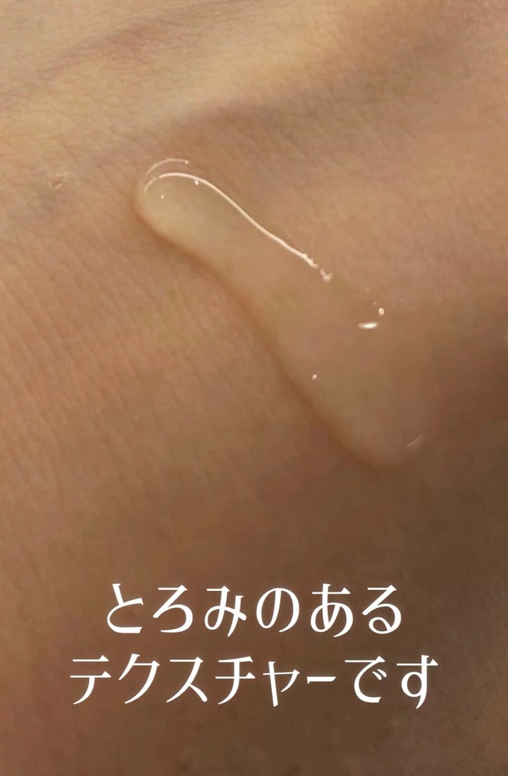 エファクラ ピールケア セラム/ラ ロッシュ ポゼ/美容液を使ったクチコミ(1枚目)