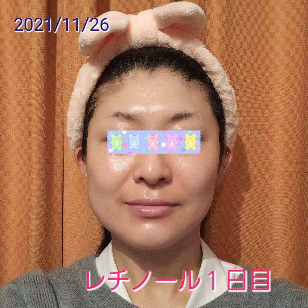 スーパーリンクルセラムVA/KISO/美容液を使ったクチコミ（1枚目）