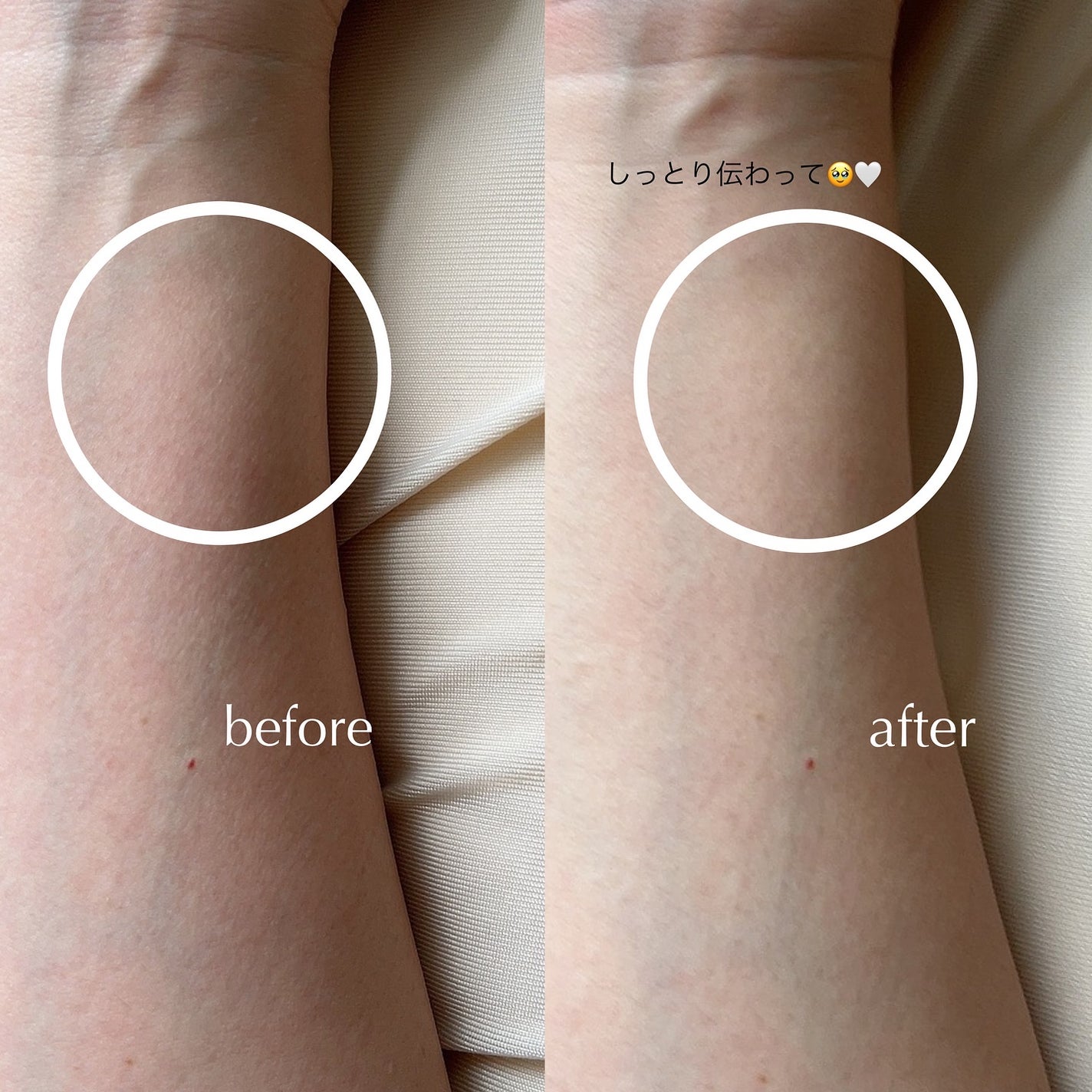 NIACIN 20% セラム/TIRTIR(ティルティル)/美容液を使ったクチコミ(4枚目)