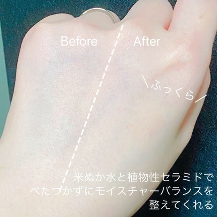 塗る米ぬか化粧水/米一途/化粧水を使ったクチコミ(6枚目)