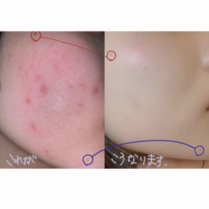 ダブル ロングウェアー カバー ファンデーション/PERIPERA/リキッドファンデーションを使ったクチコミ(3枚目)