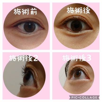 EYE2IN 低刺激 セルフプロ用 まつげパーマ 3種 セット/Qoo10/その他キットセットを使ったクチコミ(2枚目)