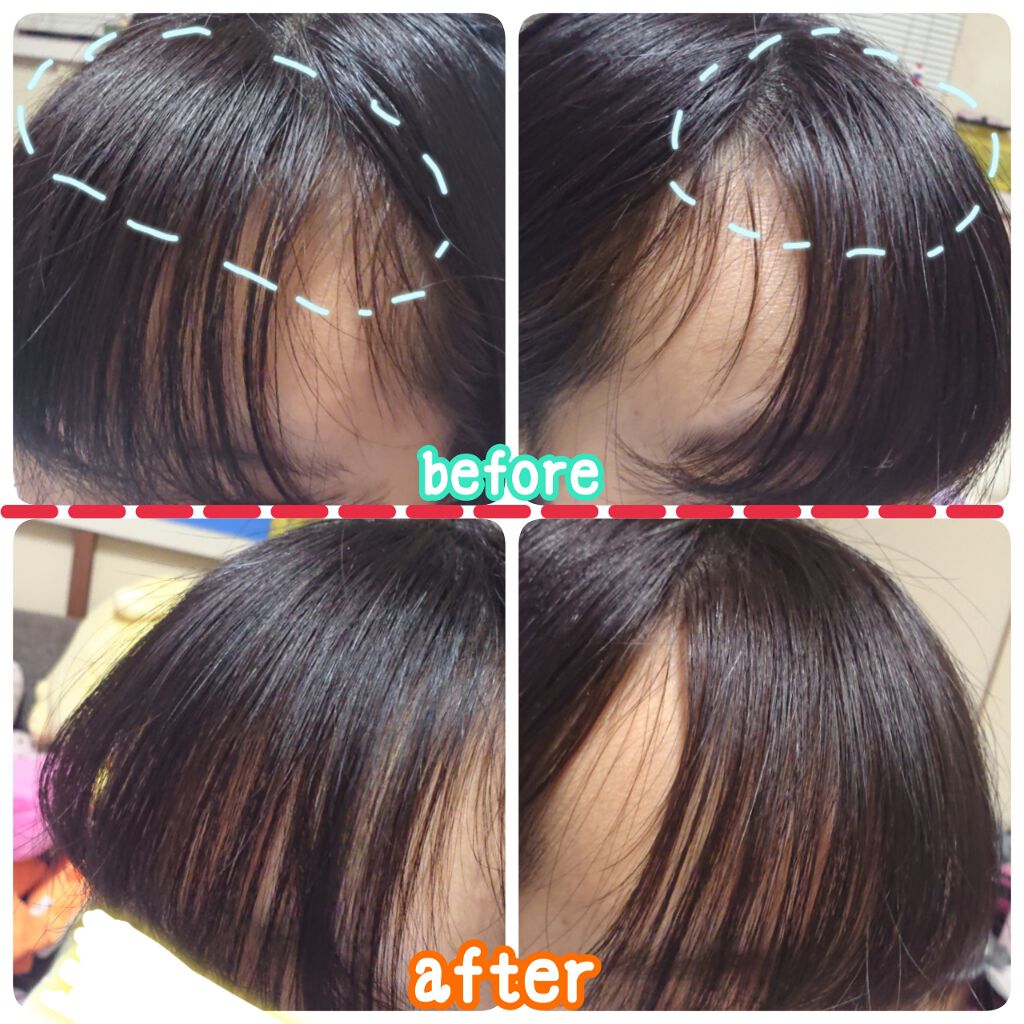 ミラクルズ ボリューム ドライシャンプー/パンテーン/ドライシャンプーを使ったクチコミ（2枚目）