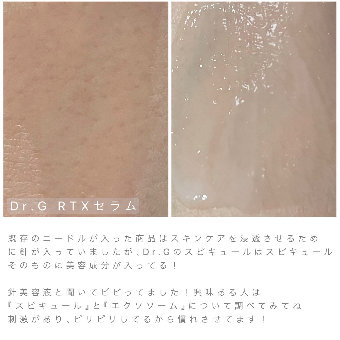 RTXセラム ビタミンショット/Dr.G/美容液を使ったクチコミ(3枚目)