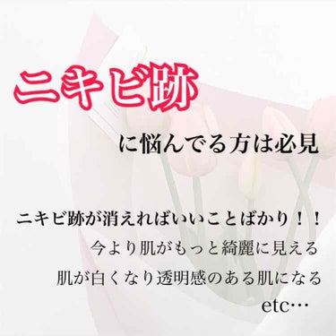 初めまして、すぴか🌙です
まだ慣れていませんがこれから頑張りたいと
思うのでよろしくお願いします🙇🏻‍♀️

今回は《ニキビ跡を消す方法》を
紹介したいと思います！！

ニキビ跡が消えればいいことばかり