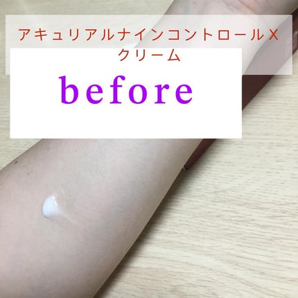 アキュリアルナインコントロールエックスクリーム/ACWELL/フェイスクリームを使ったクチコミ(4枚目)