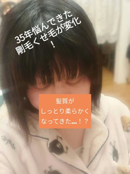 グリセリンP「ケンエー」/健栄製薬/その他を使ったクチコミ(1枚目)