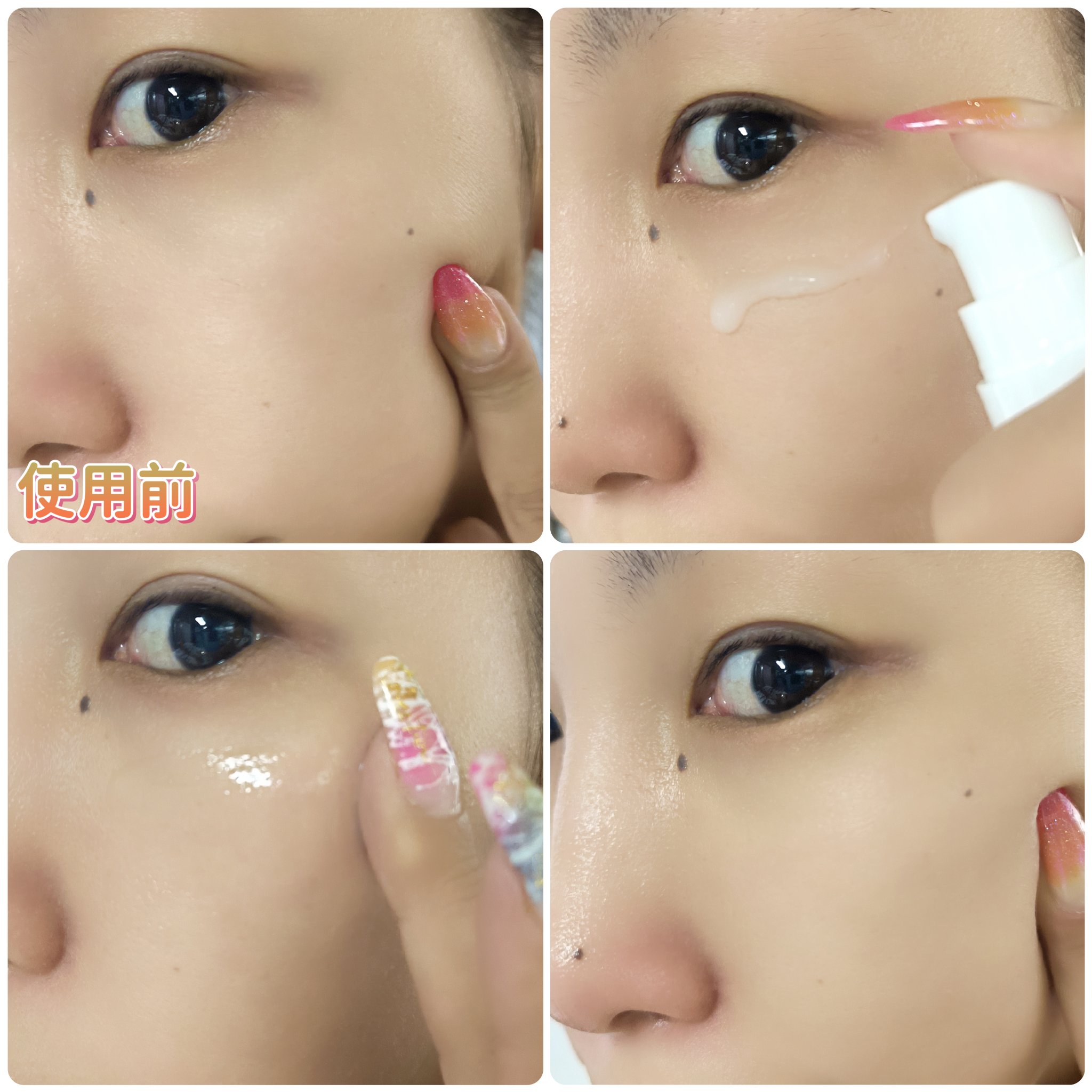 ビディ ニードルエッセンス GG/ビディ/美容液を使ったクチコミ（3枚目）