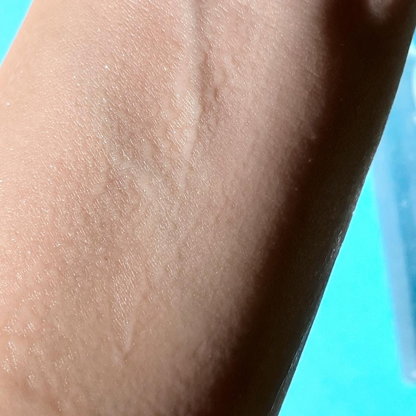 アクアヒアルロニックエッセンス/ロベクチン/化粧水を使ったクチコミ(5枚目)