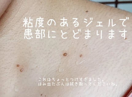 イポケアEX ジェルパッチ/ブレーンコスモス/その他スキンケアを使ったクチコミ(3枚目)