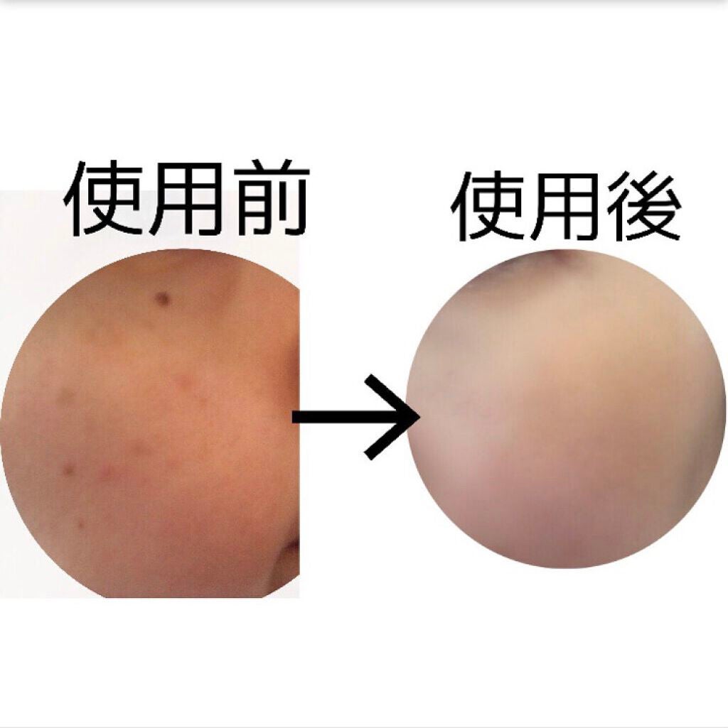 24 ミネラルモイストスティックファンデ/24h cosme/その他ファンデーションを使ったクチコミ(2枚目)