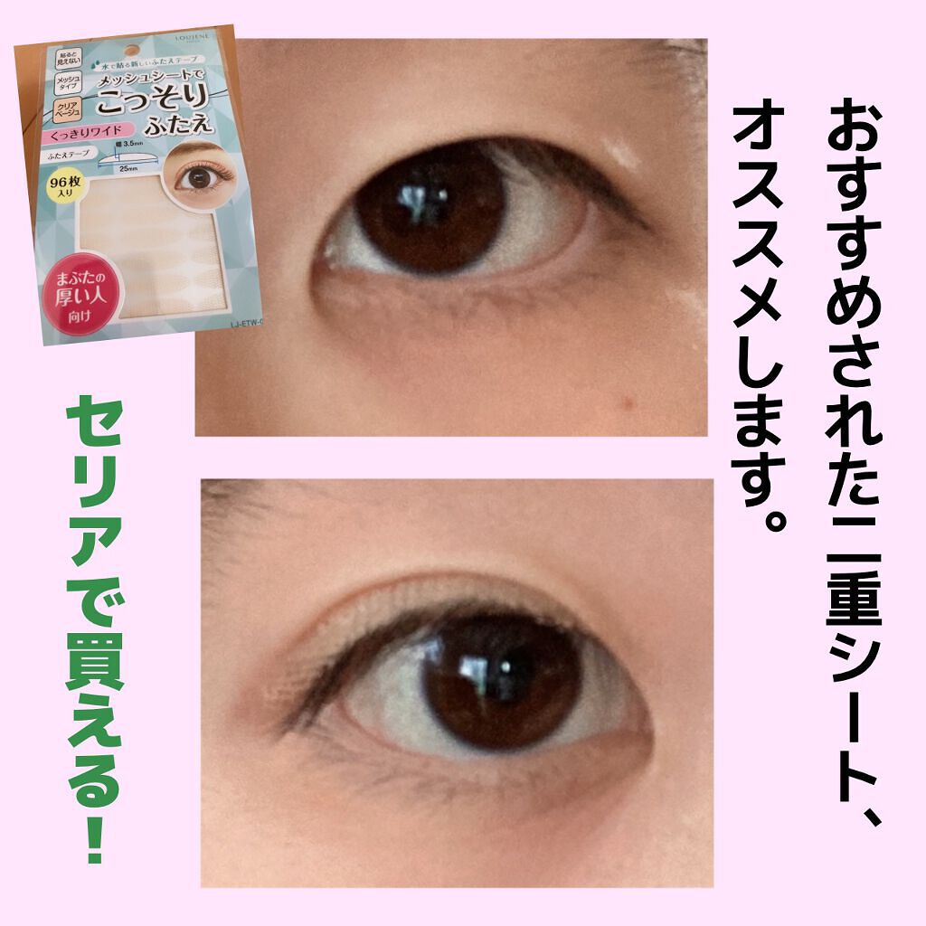 アイトーク スーパーホールド/アイトーク/二重まぶた用アイテムを使ったクチコミ（1枚目）