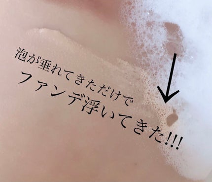 ビフィダアンプル弱酸性ジェルクレンザー/manyo/クレンジングジェルを使ったクチコミ(5枚目)