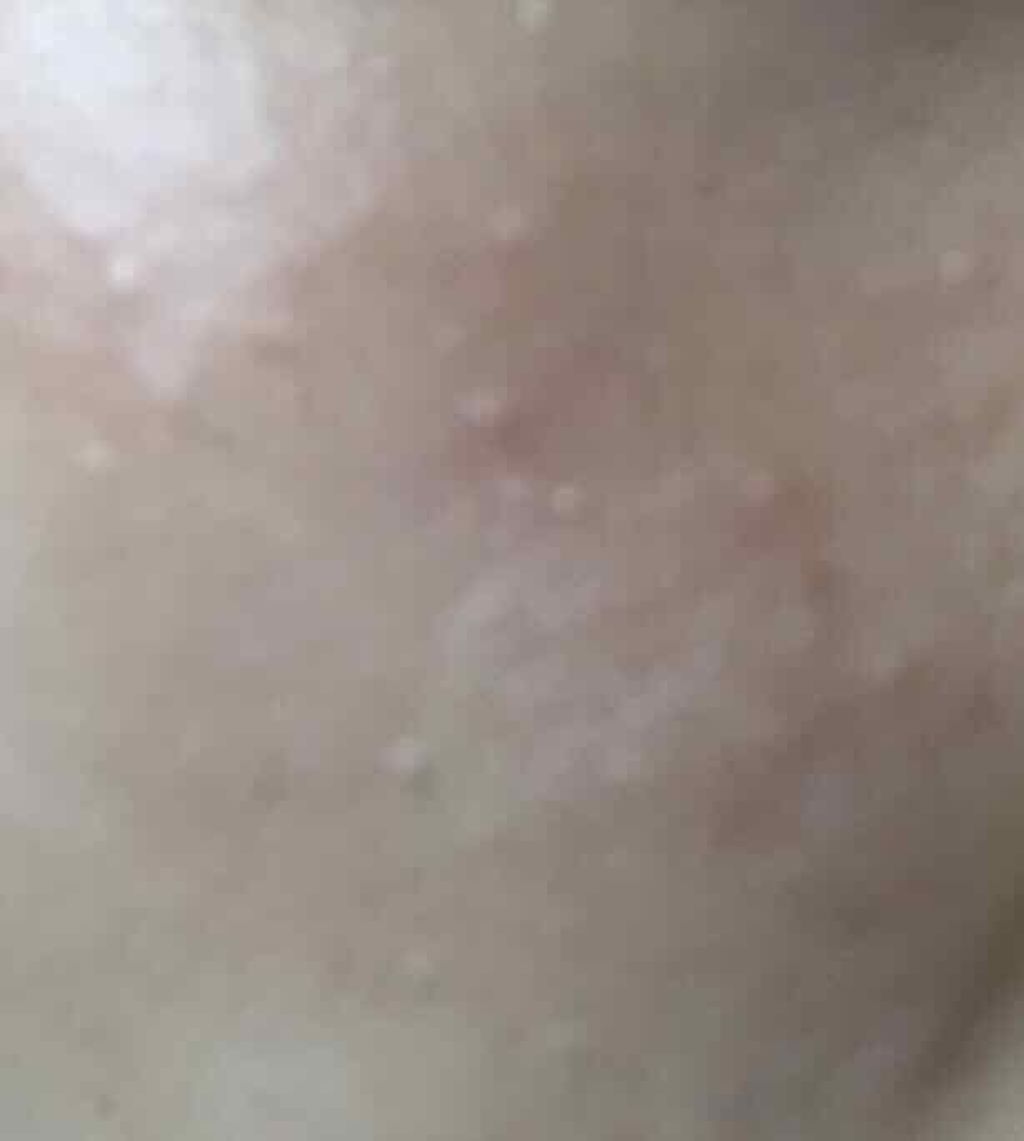 ハトムギ化粧水(ナチュリエ スキンコンディショナー R )/ナチュリエ/化粧水を使ったクチコミ（3枚目）