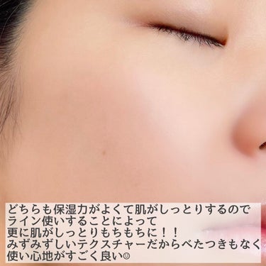 ena.  on LIPS 「〈ONEBYKOSE肌人生を原点から変える〉ーーーーーーーーー..」（3枚目）