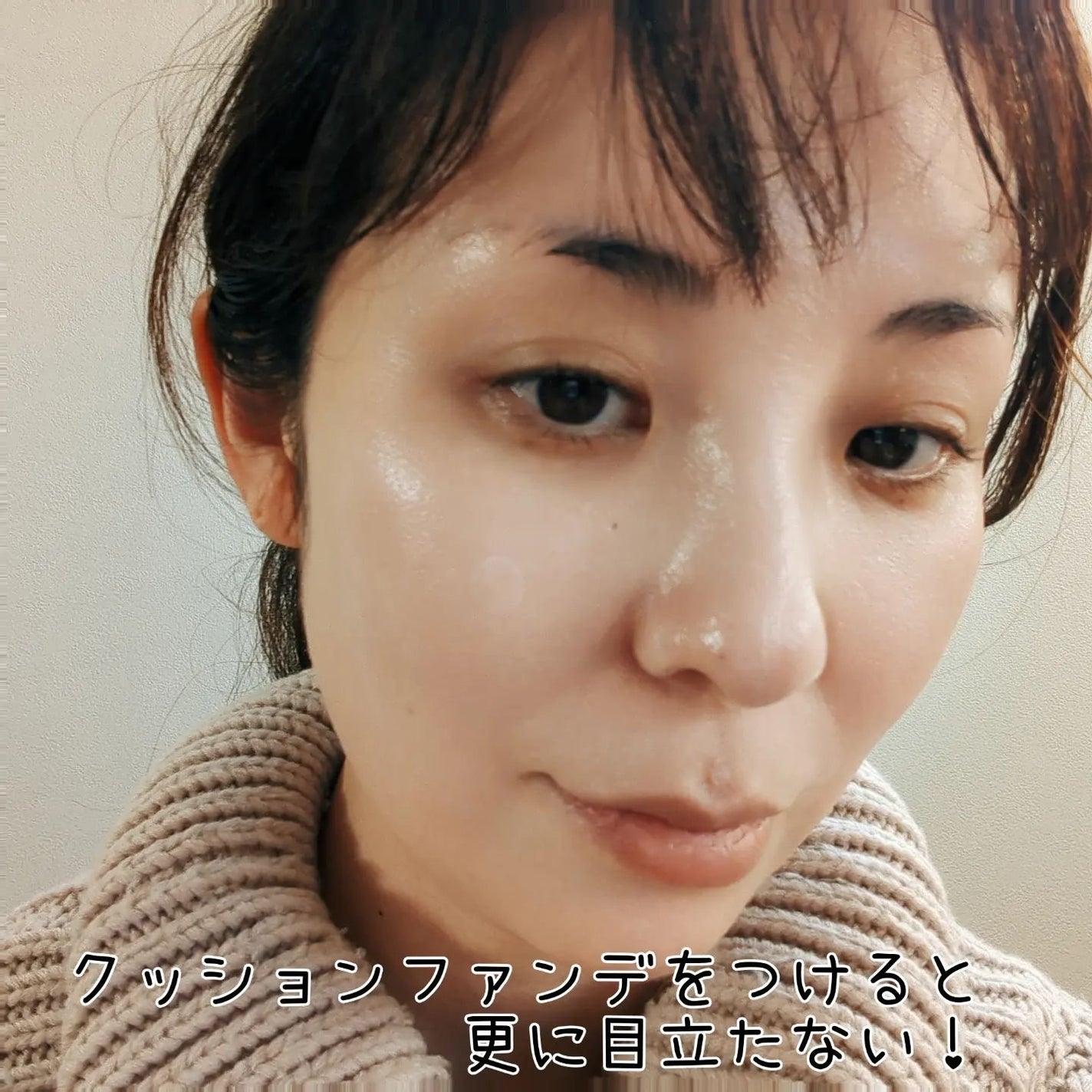 キャッチミーパッチ/CATCH ME PATCH/にきびパッチを使ったクチコミ(5枚目)