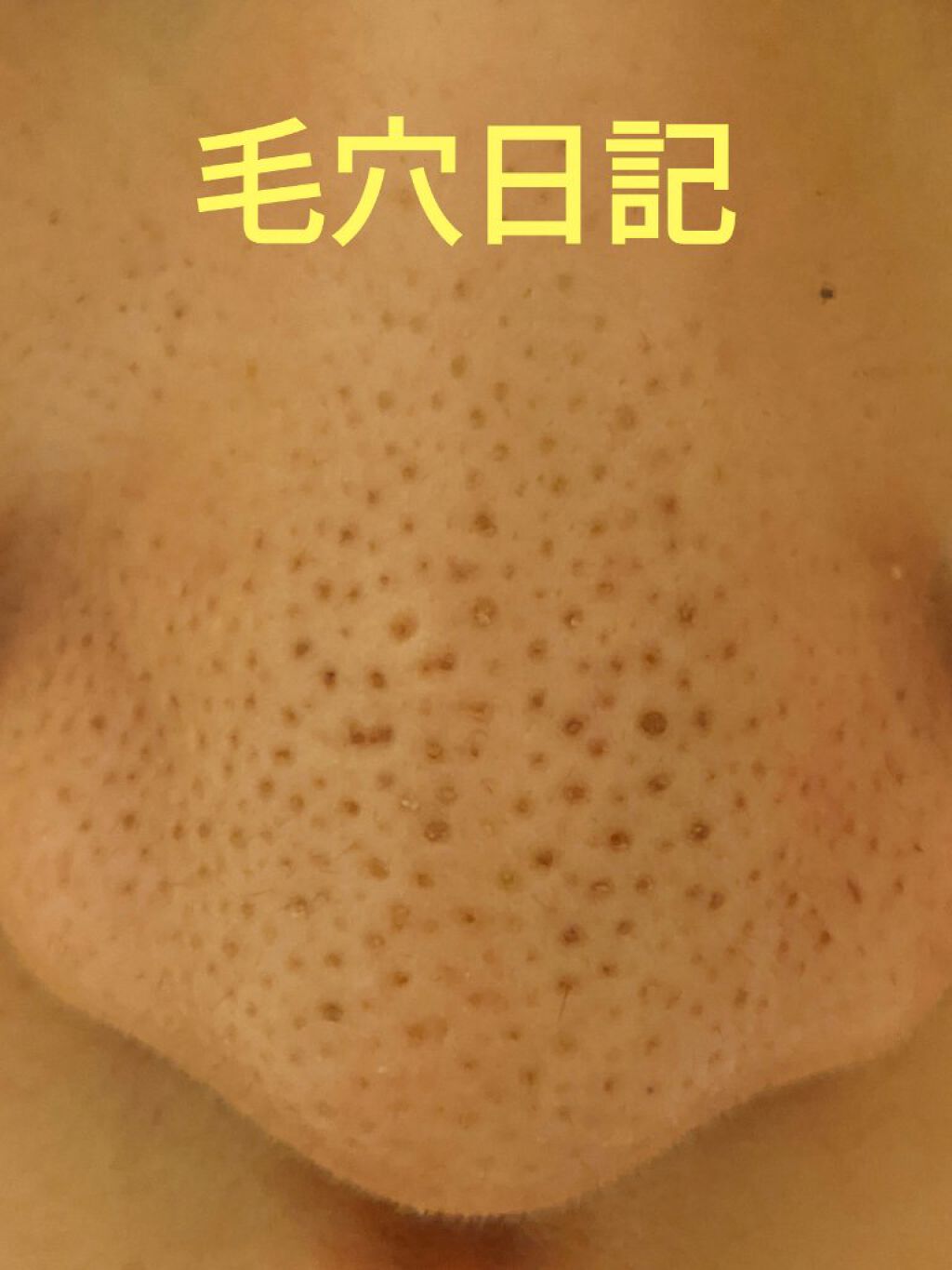 デュオ ザ クレンジングバーム/DUO/クレンジングバームを使ったクチコミ（1枚目）