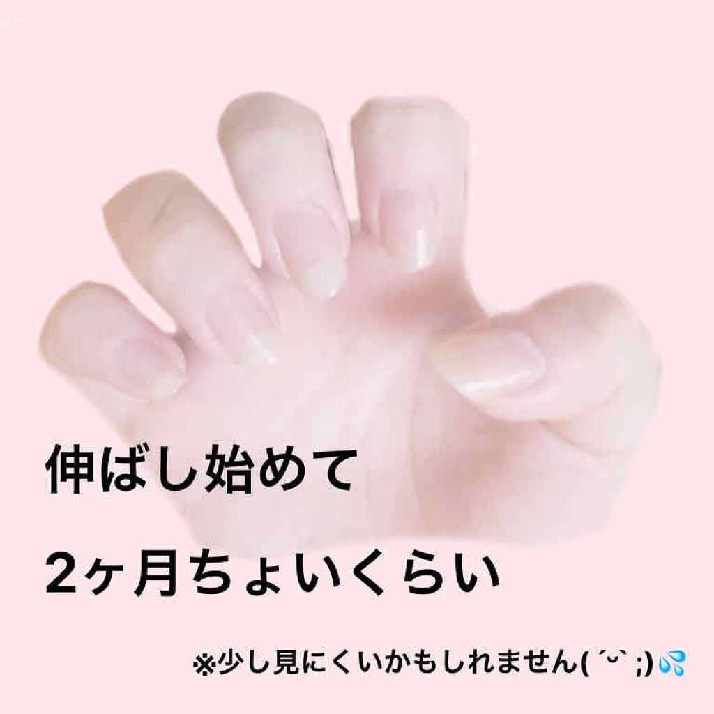 ネイルサポート Na/ネイルネイル/ネイルトップコートを使ったクチコミ(2枚目)