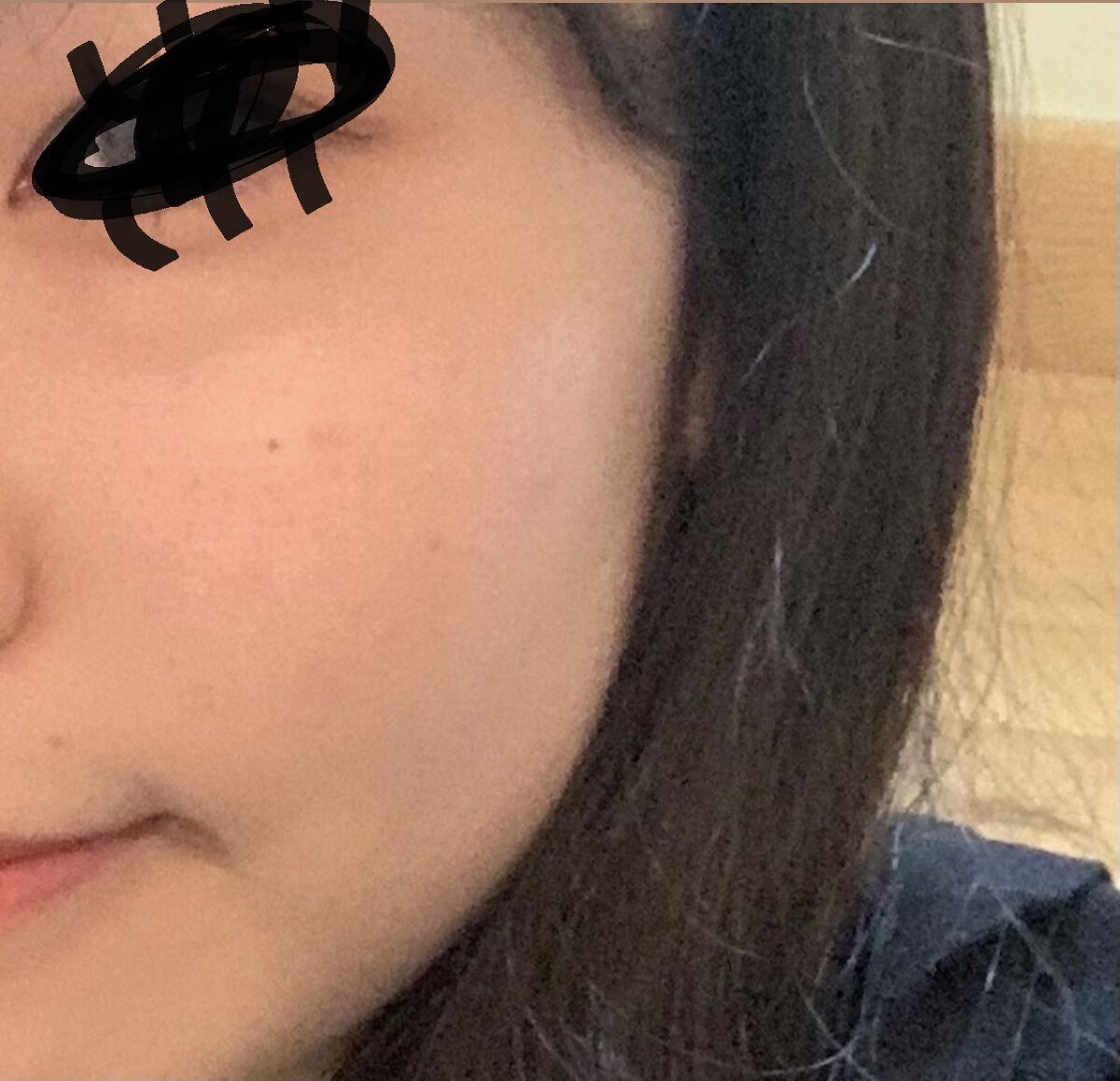 ペアアクネクリームW(医薬品)/ペア/その他を使ったクチコミ（2枚目）