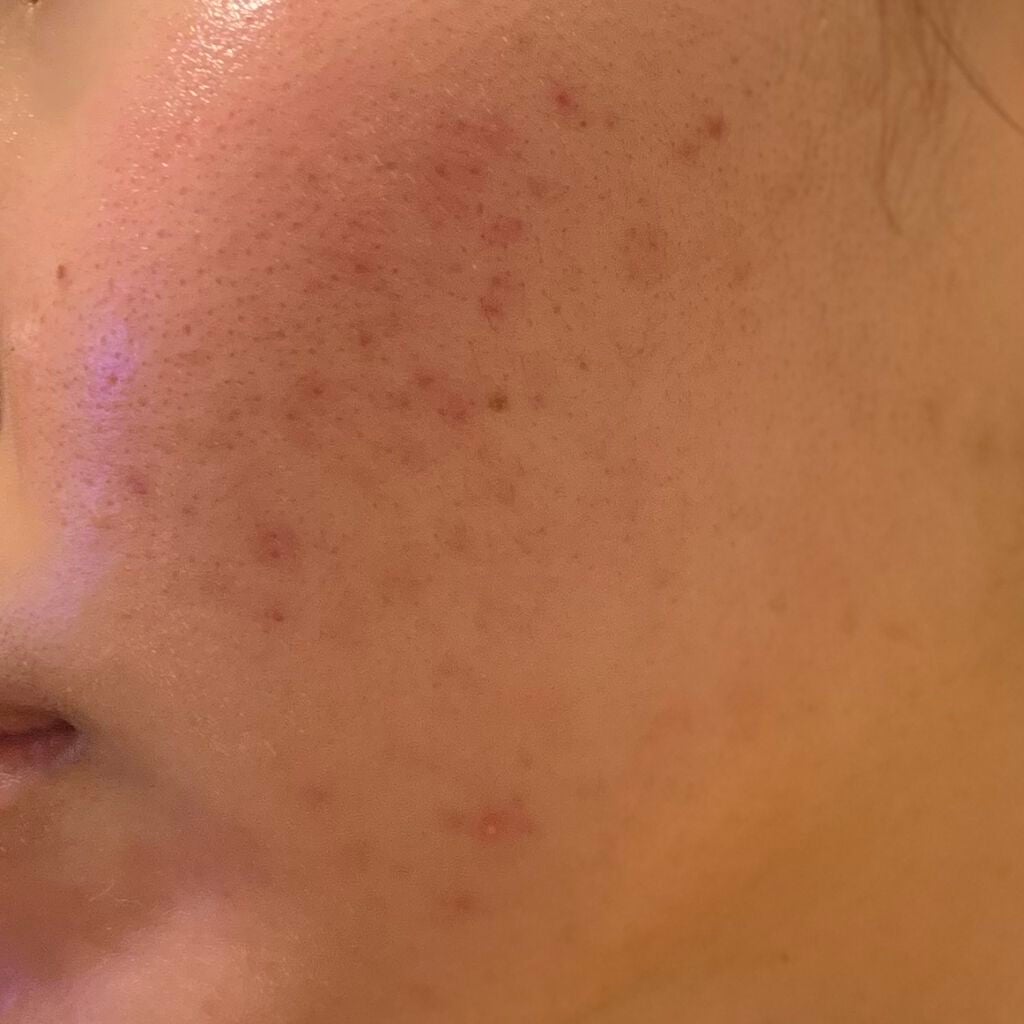 経過観察するよ on LIPS 「初めて外カメで撮ったらめちゃめちゃ現実味させられて汚い、、でも..」(1枚目)