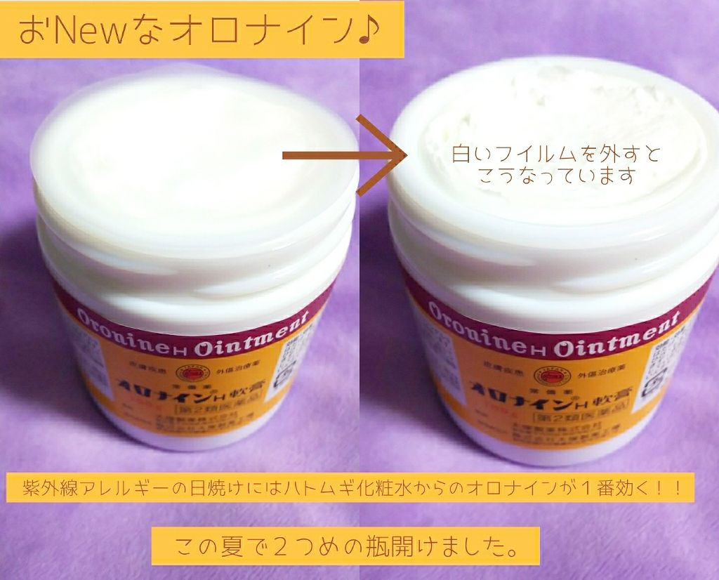 オロナインＨ軟膏 (医薬品)/オロナイン/その他を使ったクチコミ（1枚目）