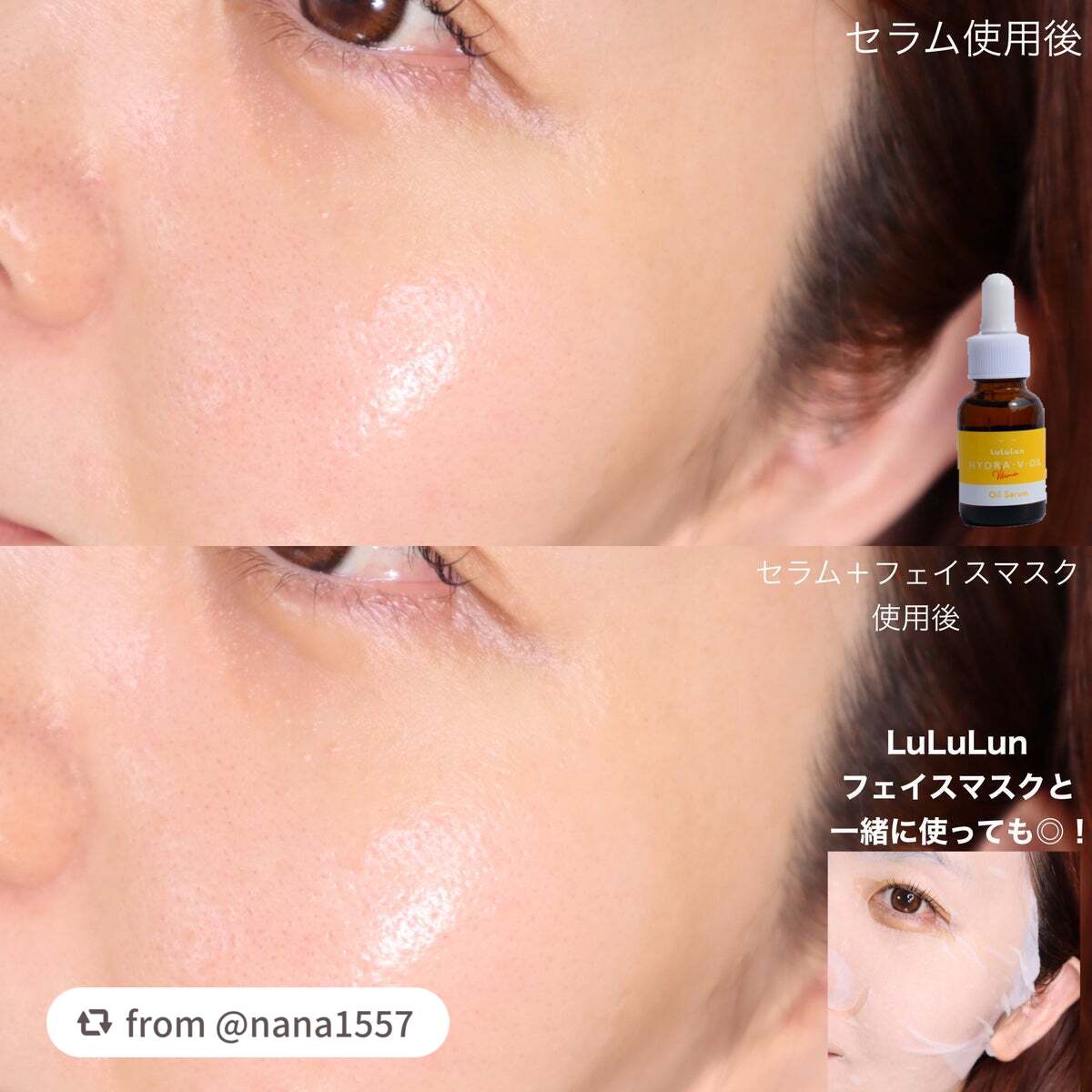 ルルルン ハイドラ V オイルセラム/ルルルン/美容液を使ったクチコミ(5枚目)