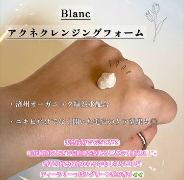 ブラン マジックトラブル洗顔のクチコミ「こちらはBlanc アクネクレンジングフォームです🫶




今あるニキビも
これからできるニ.....」（2枚目）