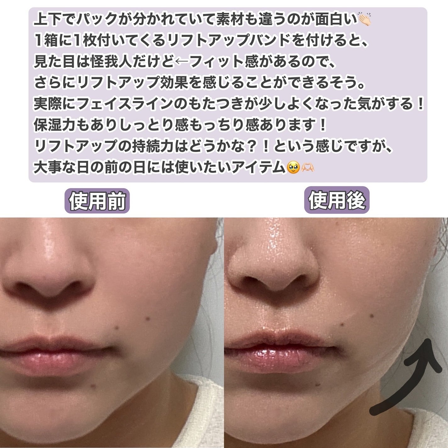 9番 NMNバイオリフトラッピングマスク/numbuzin/シートマスク・パックを使ったクチコミ(6枚目)