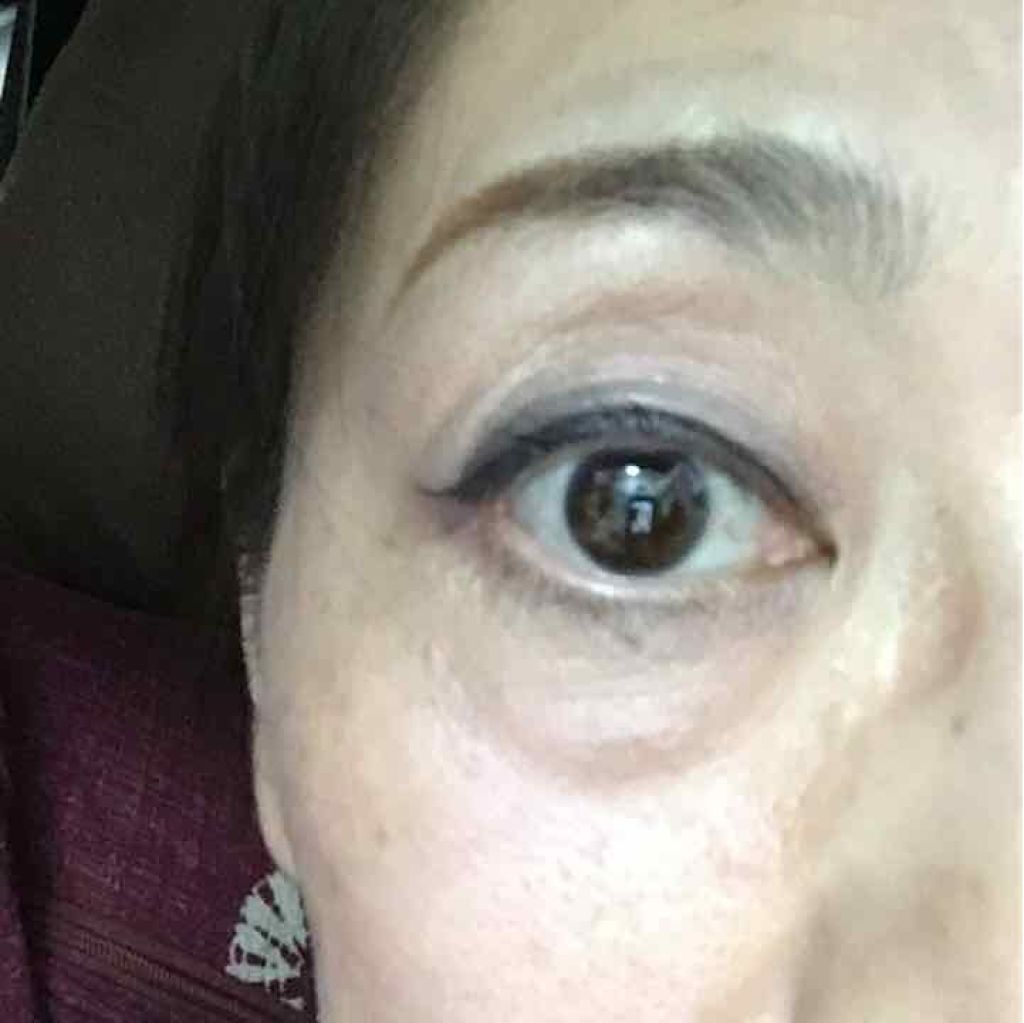 チョコラBBハイパー/チョコラBB/美容ドリンクを使ったクチコミ（1枚目）