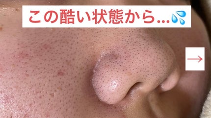 ã䜿ã£ãã¯ãã³ãïŒ1æç®ïŒ