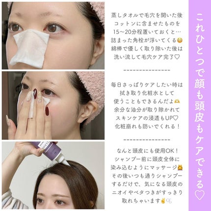 アクレオンセボエクストラクター/ANACIS/その他スキンケアを使ったクチコミ(3枚目)