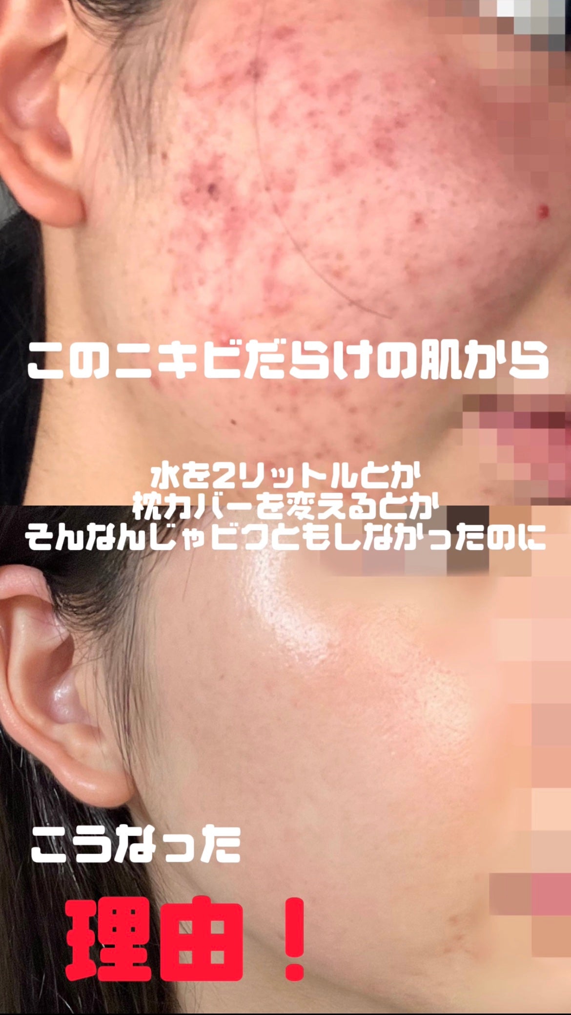 なナ on LIPS 「水を2リットル飲む、毎日枕カバーを変える、○○の化粧水を使う…..」(1枚目)