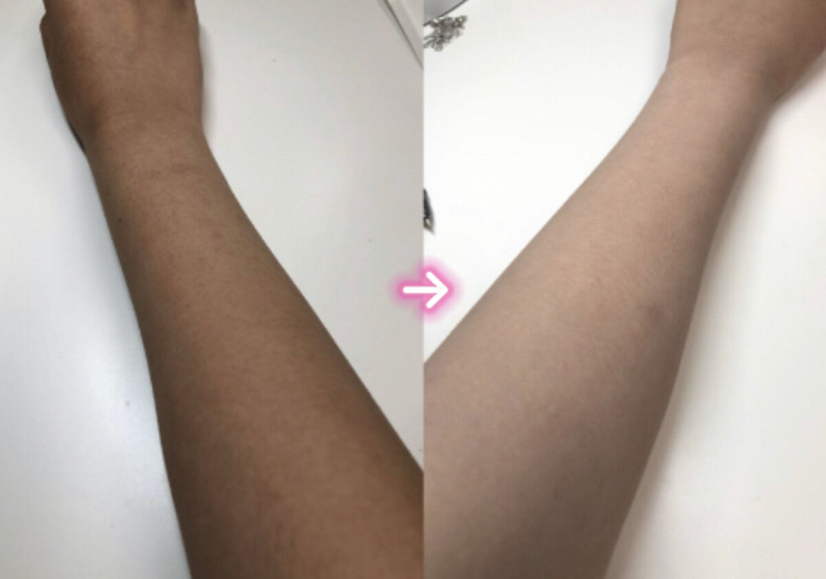 薬用ホワイトコンク ホワイトニングCC CII/ホワイトコンク/ボディクリームを使ったクチコミ（2枚目）