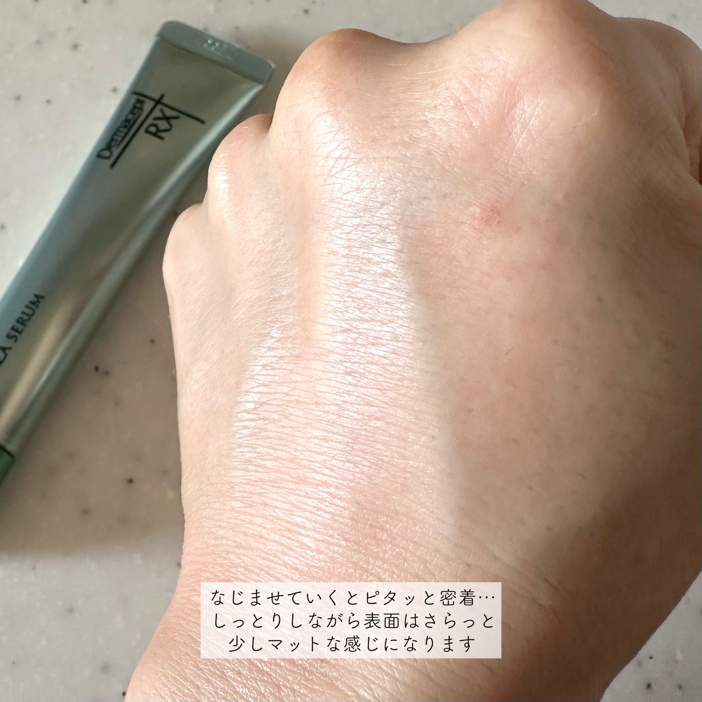 ダーマセプトRX AZAセラム/ダーマセプトRX/美容液を使ったクチコミ(5枚目)