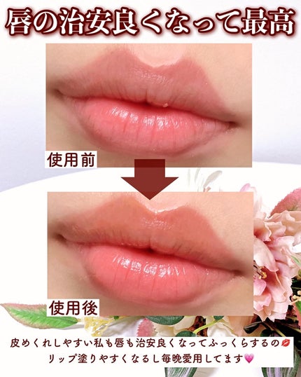 リップスリーピングマスク ドリーミーリップキット/LANEIGE/その他キットセットを使ったクチコミ(8枚目)