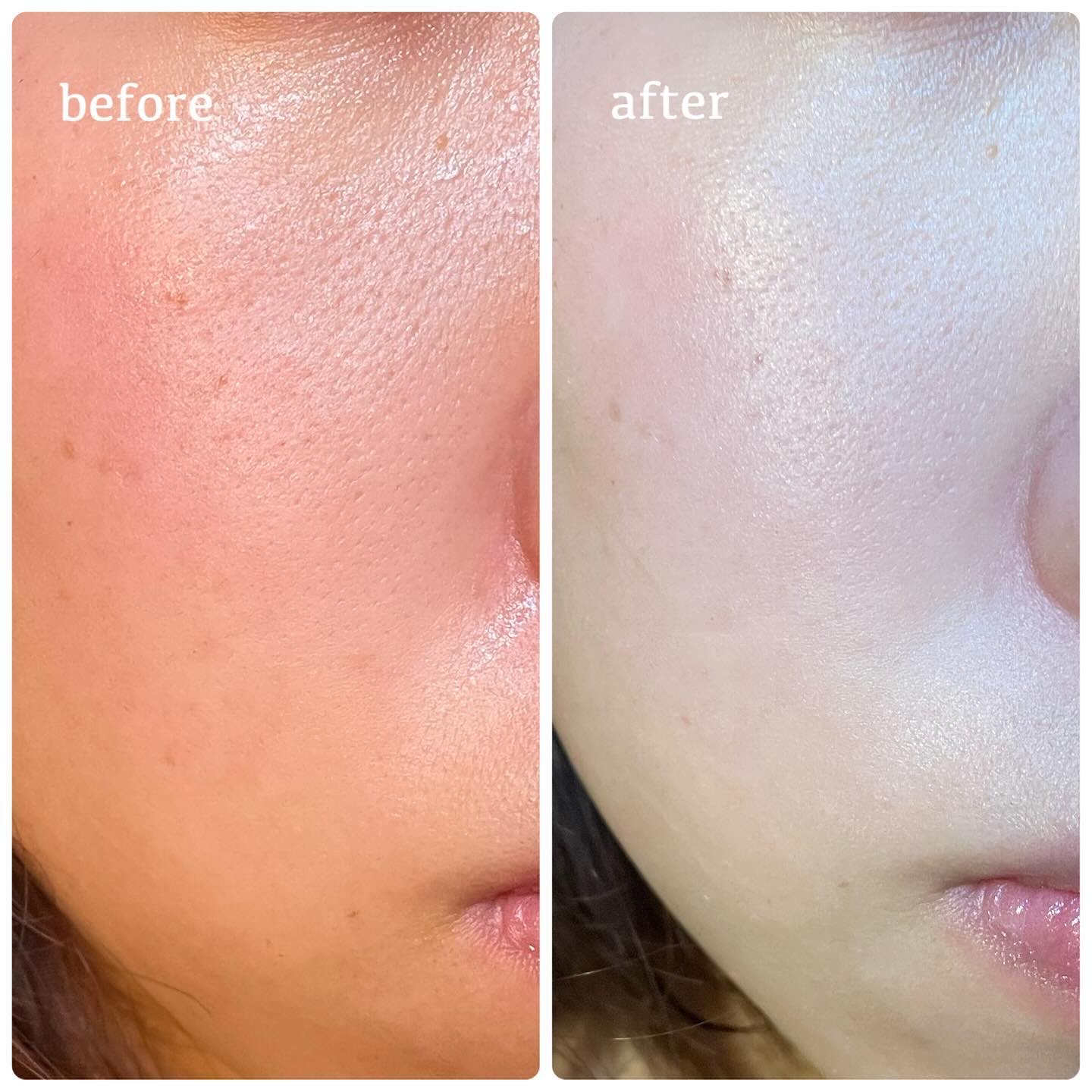 ブリージンググロークッション/Healus/クッションファンデーションを使ったクチコミ（2枚目）