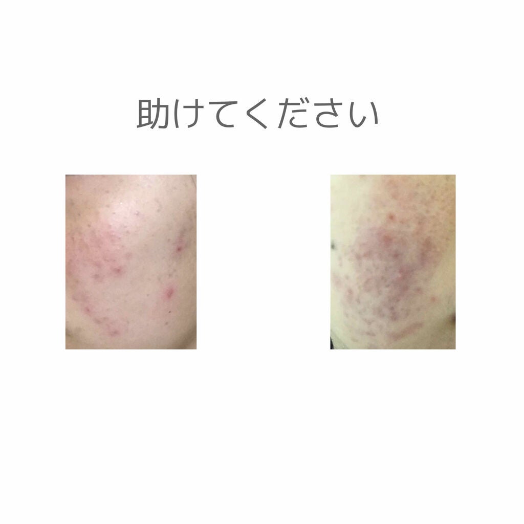 ハトムギ化粧水(ナチュリエ スキンコンディショナー R )/ナチュリエ/化粧水を使ったクチコミ(1枚目)