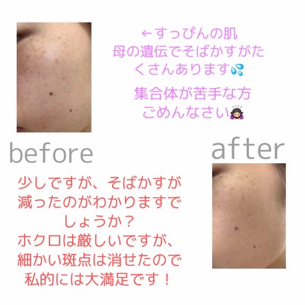 フィットミー リキッドファンデーション R/MAYBELLINE NEW YORK/リキッドファンデーションを使ったクチコミ(3枚目)