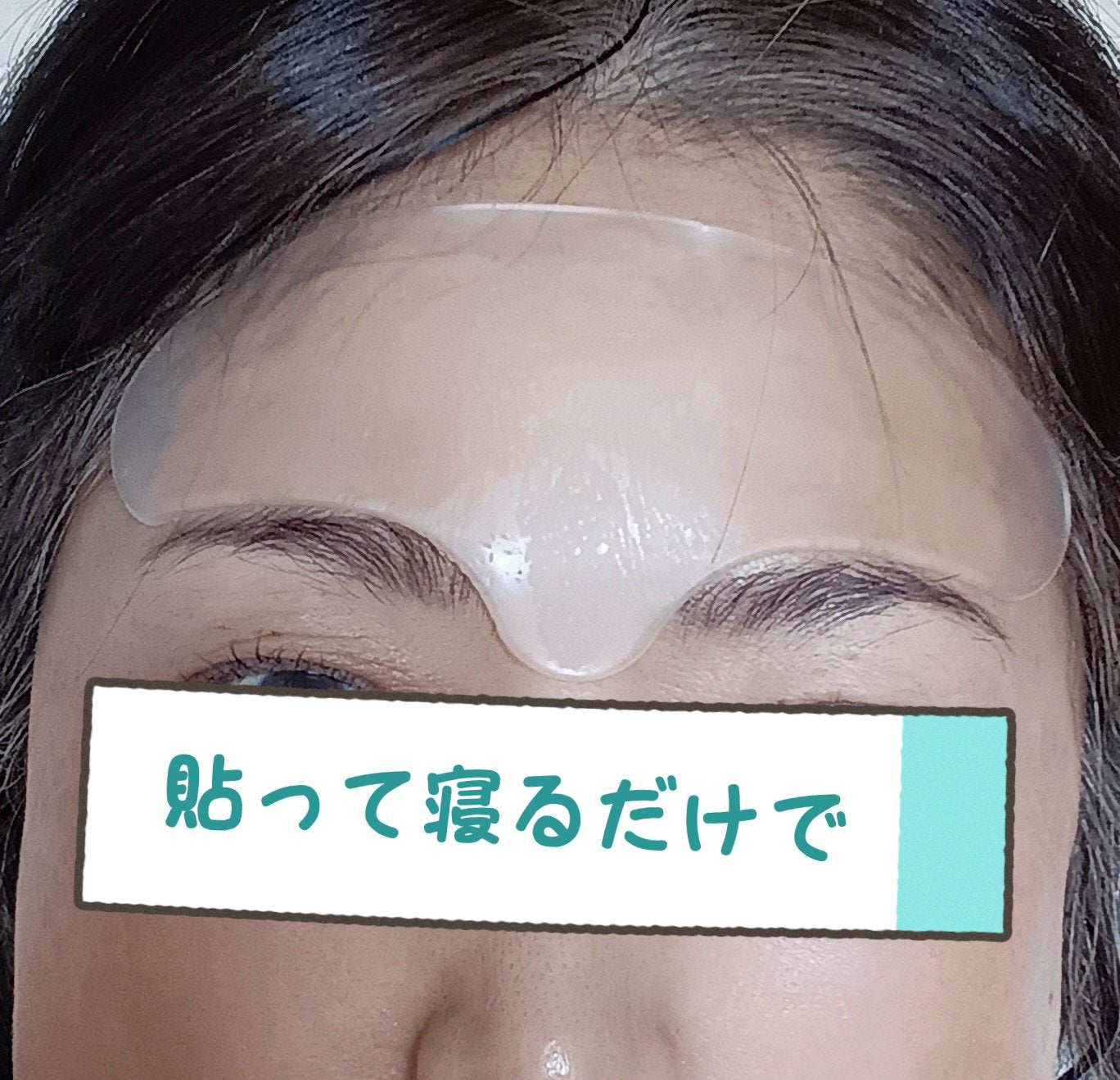 おでこでシワ取りパッチ/その他を使ったクチコミ(1枚目)