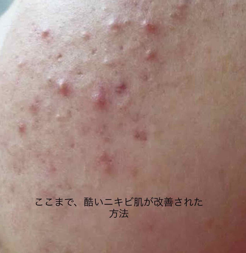 ニベアクリーム/ニベア/ボディクリームを使ったクチコミ（1枚目）