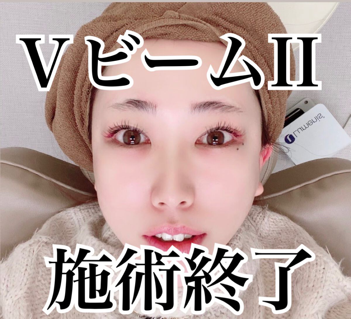 トレリアン 薬用モイスチャーローション/ラ ロッシュ ポゼ/化粧水を使ったクチコミ（3枚目）