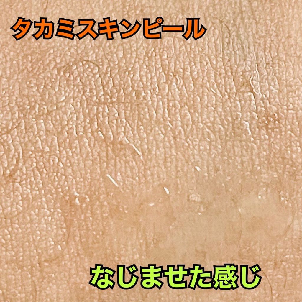 タカミスキンピール/タカミ/ブースター・導入液を使ったクチコミ(3枚目)